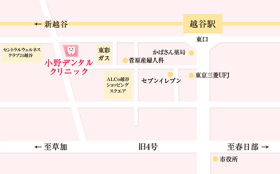 簡略図